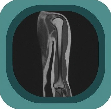 MRI upper arm anatomy icon-1771230546